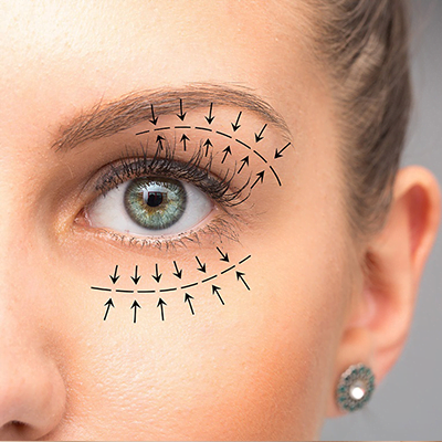 eyelid-surgery-blepharoplasty