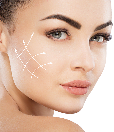 facelift